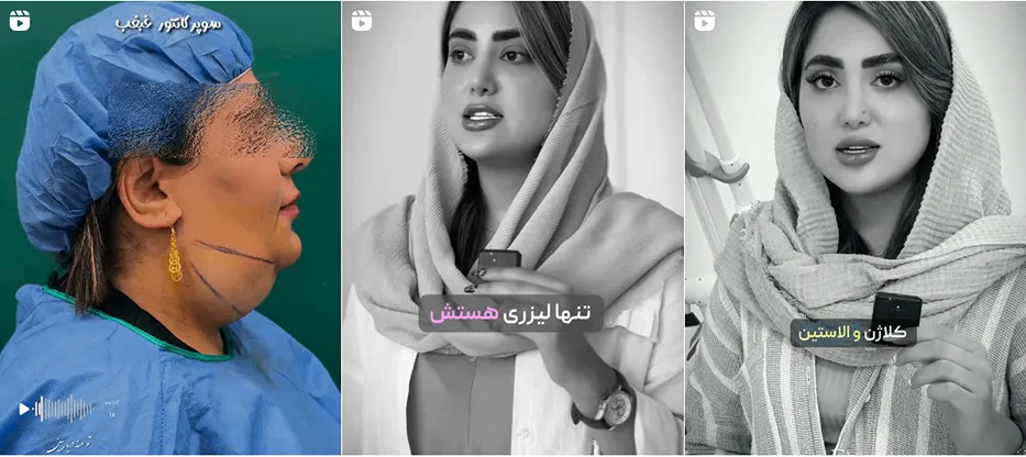 نمونه کار یکی از موفق ترین کلینیک لیزر در ایلام را مشاهده میفرمایید.