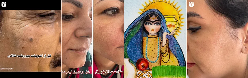 بهترین کلینیک و مرکز پاکسازی پوست در یزد(فیشیال)+ 1404