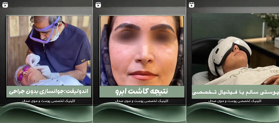 بهترین مرکز فیشال پوست در اصفهان تویط دکتر گیتا فقیهی انجام میپذیرد.