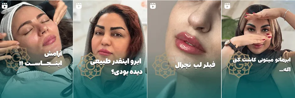 بهترین کلینیک و مرکز پاکسازی پوست در بوشهر(فیشیال)+ 1404