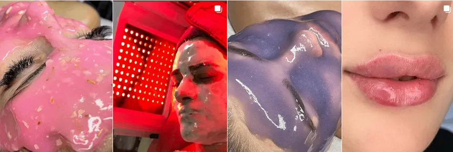 بهترین کلینیک و مرکز پاکسازی پوست در قزوین(فیشیال)+ 1404