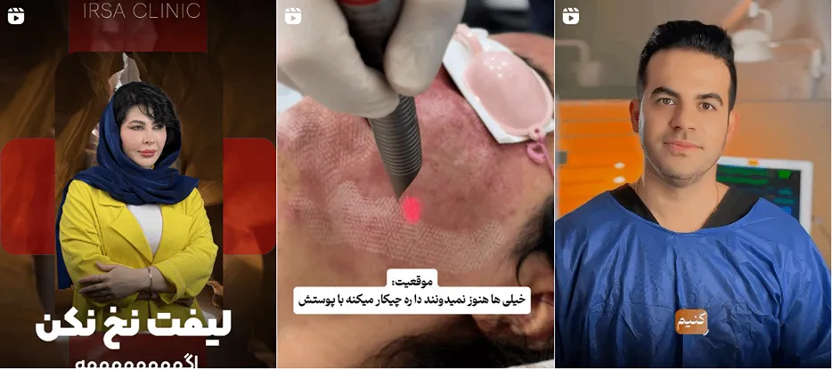 بهترین کلینیک و مرکز پاکسازی پوست در شیراز(فیشیال)+ 1404