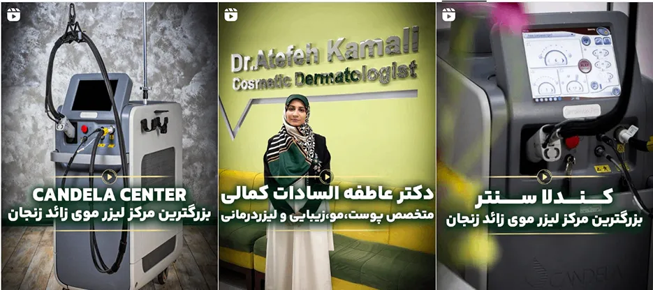 نمونه کار یکی از موفق ترین مراکز لیزر در زنجان را مشاهده میفرمایید.