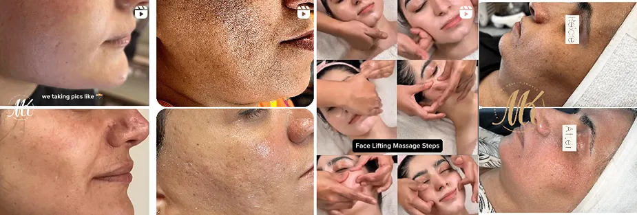 بهترین کلینیک و مرکز پاکسازی پوست در کرمان(فیشیال)+ 1404