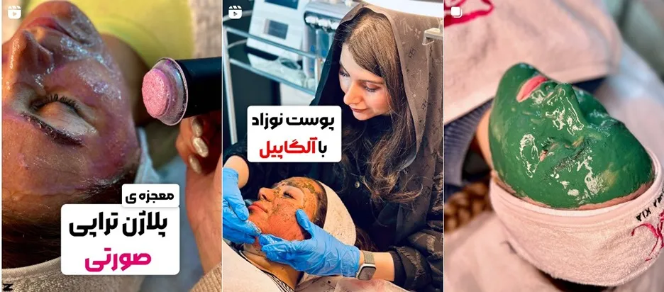 پاکسازی تخصصی پوست در تهران توسط خانم زهرا کیا صورت میپذیرد
