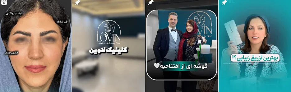 بهترین کلینیک و مرکز پاکسازی پوست در اراک(فیشیال)+ 1404