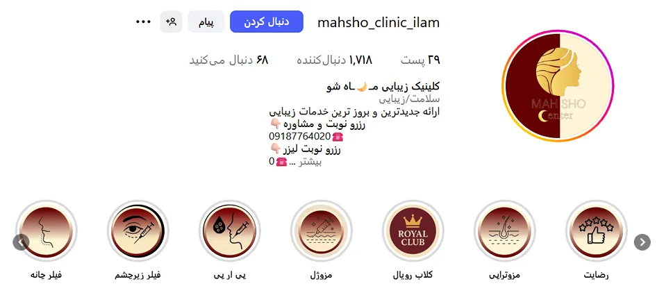 لیزر ایلام در کلینیک زیبایی ماهشو کاملا قابل انجام است