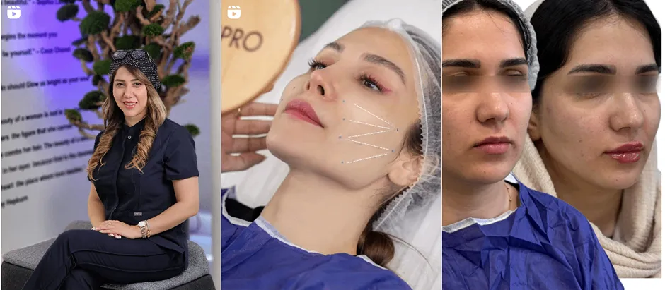 نمونه کار یکی از بهترین کلینیک لیزر در گرگان را مشاهده میفرمایید.