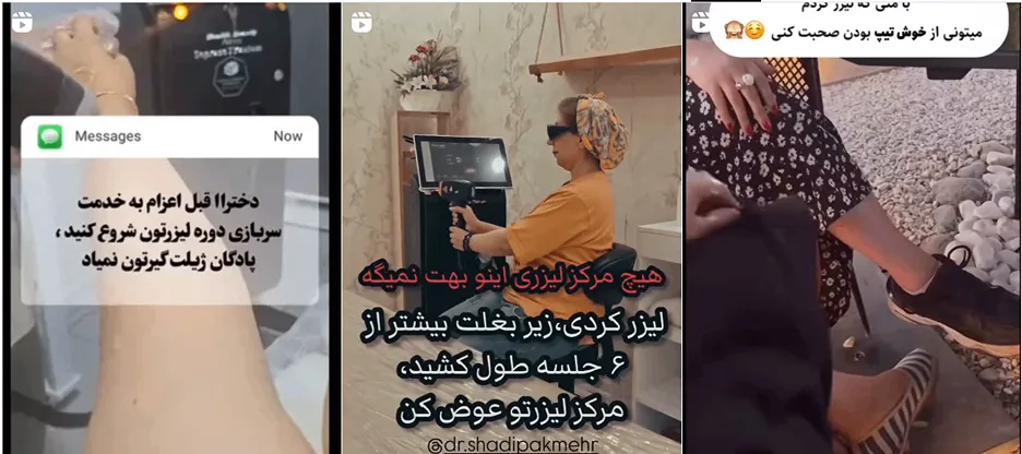 نمونه کار یکی از بهترین مرکز لیزر در خرم آّاد را مشاهده میفرمایید.