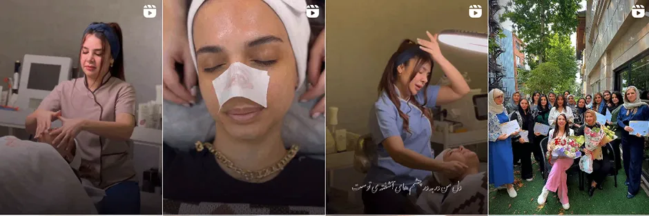 بهترین کلینیک و مرکز پاکسازی پوست در رشت (فیشیال)+ 1404