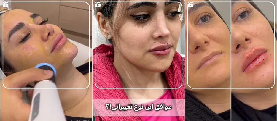 کلینیک مدس بهترین کلینیک پاکسازی پوست در کرج