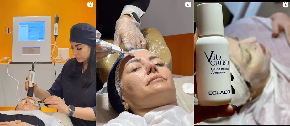 بهترین کلینیک و مرکز پاکسازی پوست در شیراز(فیشیال)+ 1404