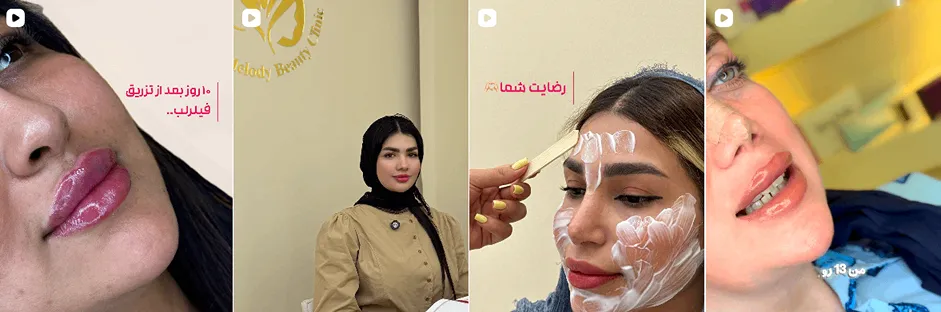 بهترین کلینیک و مرکز پاکسازی پوست در بندرعباس(فیشیال)+ 1404