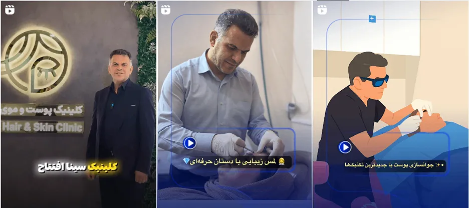 نمونه کار یکی از بهترین کلینیک لیزر در سمنان را مشاهده میفرماییید.