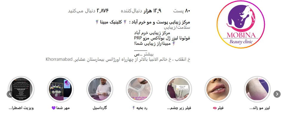 لیزر خرم آباد در کلینیک لیزر مبینا کاملا قابل انجام است