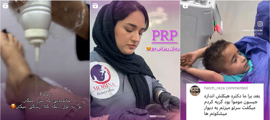 نمونه کار یکی از بهترین مراکز لیزر خرم آباد را مشاهده میفرمایید.