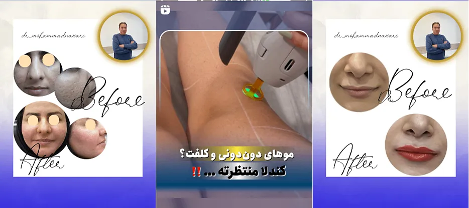 نمونه کار یکی از مهمترین مراکز لیزر در خرم آباد را مشاهده میفرمایید.