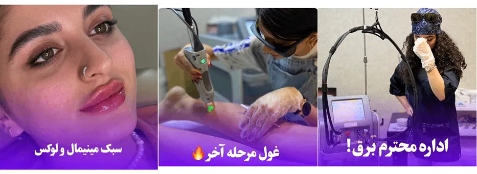 نمونه کار یکی از مدرن ترین مراکز لیزر در سمنان را مشاهده میفرمایید.