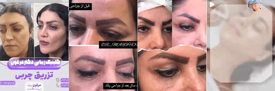 بهترین کلینیک و مرکز پاکسازی پوست در یزد(فیشیال)+ 1404