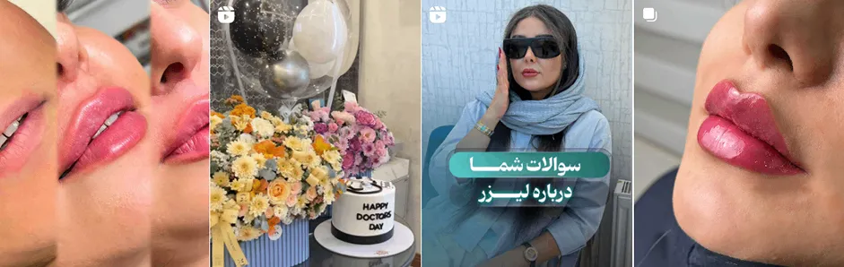 بهترین کلینیک و مرکز پاکسازی پوست در همدان (فیشیال)+ 1404