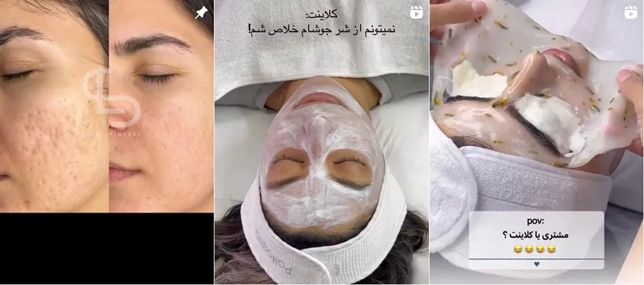 بهترین مرکز فیشیال پوست در تهران توسط لعیا صدیقی انجام میشود