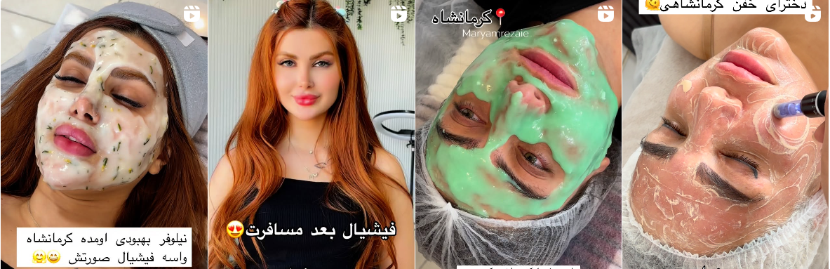 بهترین کلینیک و مرکز پاکسازی پوست در کرمانشاه(فیشیال)+ 1404