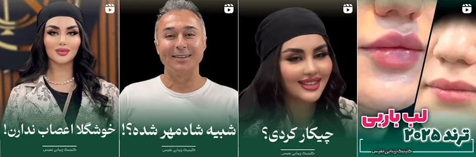 بهترین کلینیک و مرکز پاکسازی پوست در قزوین(فیشیال)+ 1404