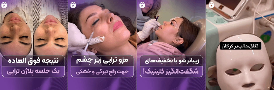 بهترین کلینیک و مرکز پاکسازی پوست در گرگان(فیشیال)+ 1404