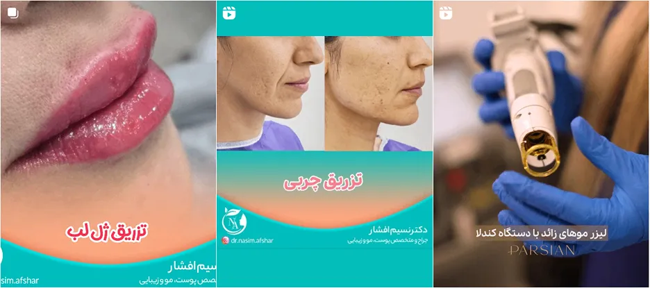 نمونه کار یکی از بهترین مراکز لیزر در ایلام را مشاهده میفرمایید.