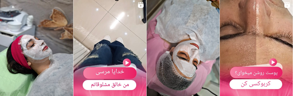 بهترین کلینیک و مرکز پاکسازی پوست در کرمانشاه(فیشیال)+ 1404