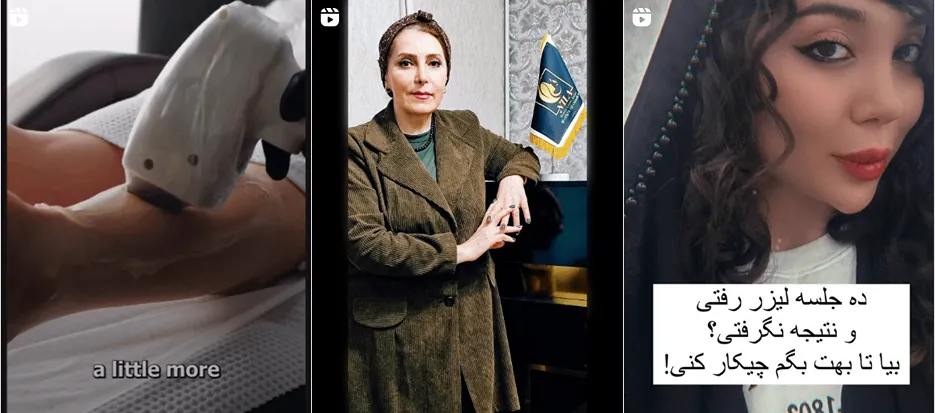 نمونه کار یکی دیگر از بهترین مرکز لیزر زنجان را مشاهده میفرمایید.