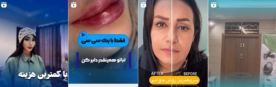 بهترین فیشال پوست در ارومیه در کلینیک زیبایی نیل انجام میشود.