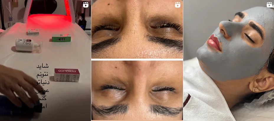 بهترین کلینیک و مرکز پاکسازی پوست در شیراز(فیشیال)+ 1404