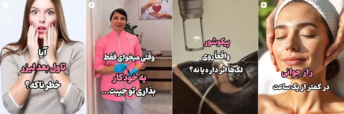 لیزر بجنورد در مرکز لیزر اکیده کاملا قابل انجام است