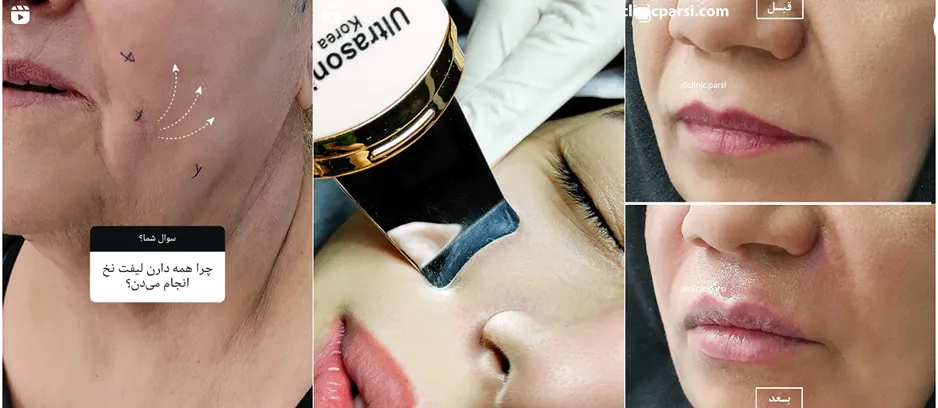 کلینیک پارسی بهترین کلینیک پاکسازی پوست