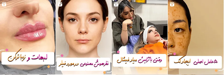 بهترین کلینیک و مرکز پاکسازی پوست در زنجان(فیشیال)+ 1404