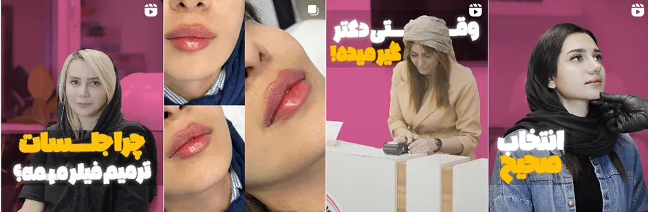 بهترین کلینیک و مرکز پاکسازی پوست در کرمان(فیشیال)+ 1404