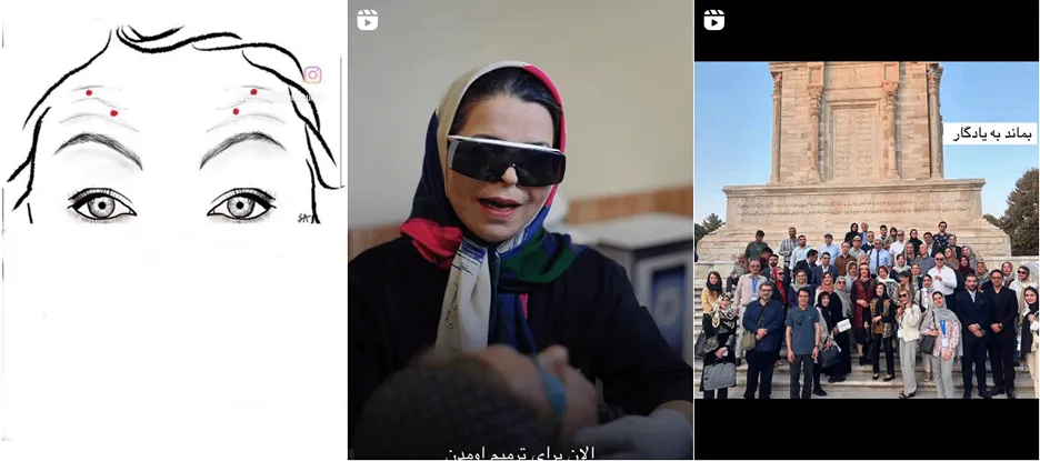 نمونه کار یکی از بهترین مراکز لیزر یزد را مشاهده میفرمایید.