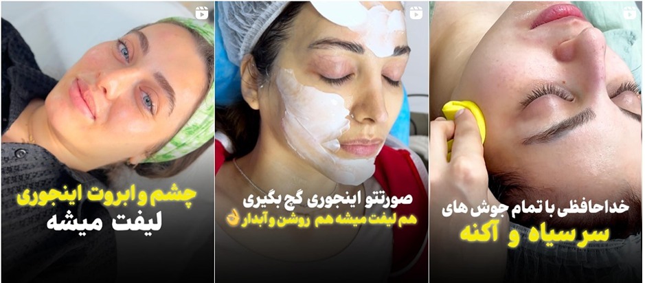 پاکسازی تخصصی پوست در تهران توسط دکتر رحیمی صورت میپذیرد