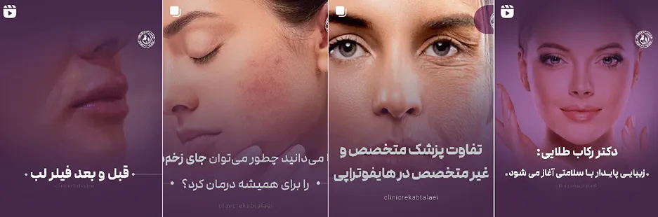 بهترین کلینیک و مرکز پاکسازی پوست در اراک(فیشیال)+ 1404