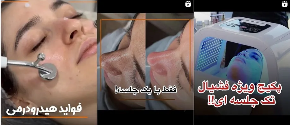 فیشال پوست در اصفهان توسط نیلوفر رضایی انجام میشود