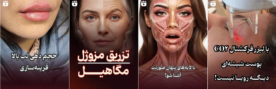 بهترین کلینیک و مرکز پاکسازی پوست در ارومیه(فیشیال)+ 1404