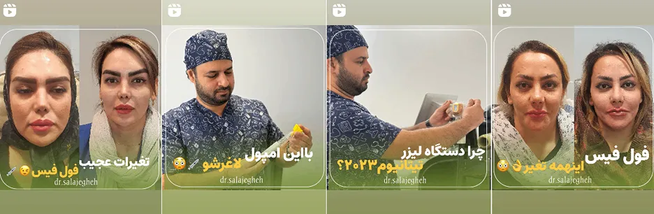 بهترین کلینیک و مرکز پاکسازی پوست در کرمان(فیشیال)+ 1404