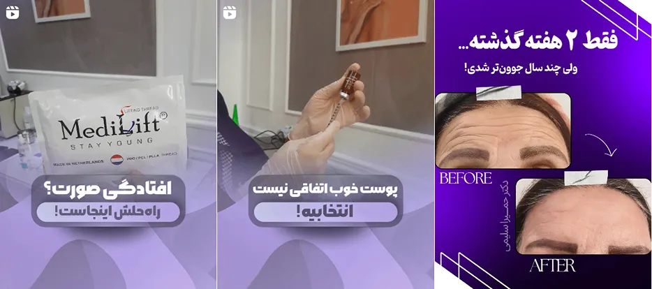 نمونه کار یکی از بهترین کلینیک لیزر در شهرکرد را مشاهده میفرمایید.