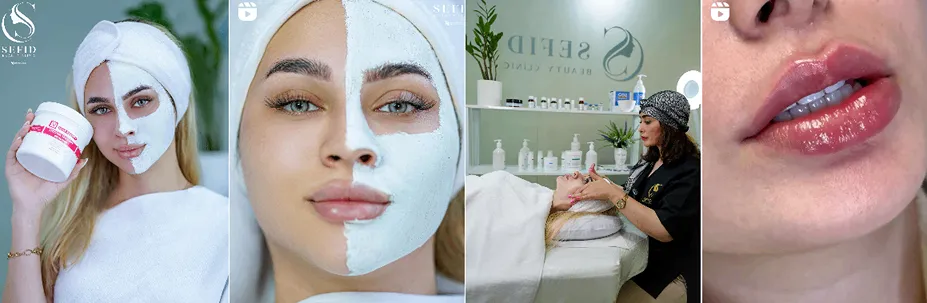 بهترین کلینیک و مرکز پاکسازی پوست در تبریز (فیشیال)+ 1404