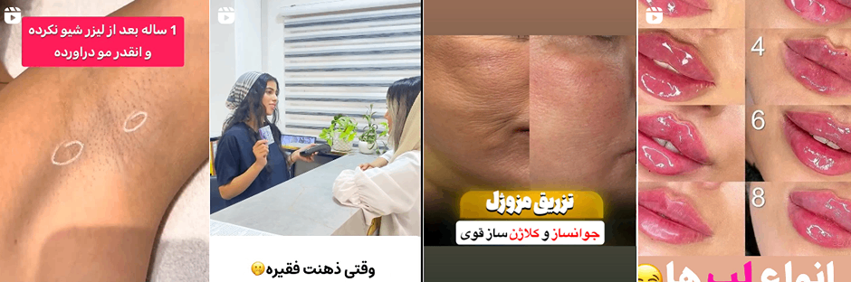 بهترین کلینیک و مرکز پاکسازی پوست در گرگان(فیشیال)+ 1404