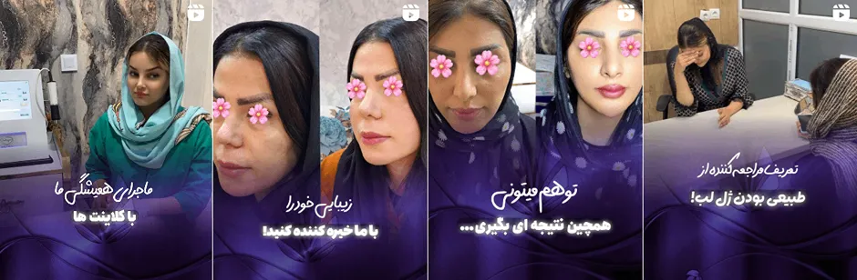 بهترین فیشال پوست در اهواز در کلینیک زیبایی دکتر بهزاد بافنده انجام میشود