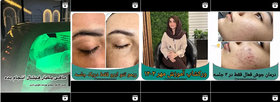 بهترین کلینیک و مرکز پاکسازی پوست در اردبیل(فیشیال)+ 1404