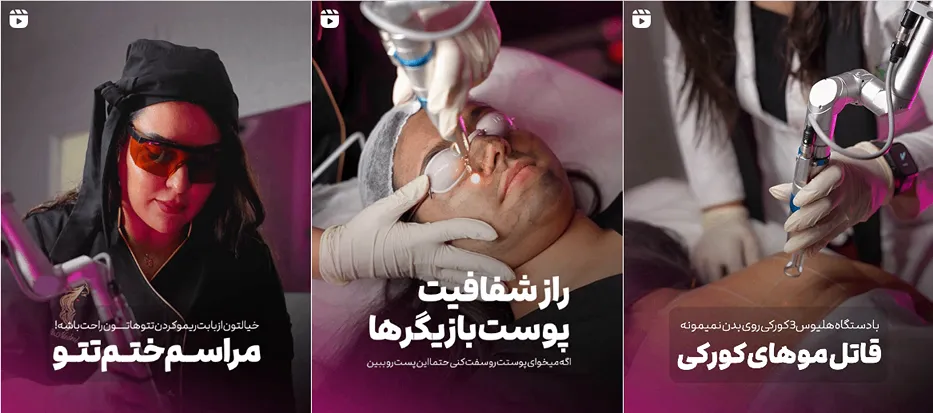 نمونه کار یکی از بهترین مراکز لیزر در سنندج را مشاهده میفرمایید.