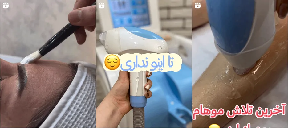 نمونه کار یکی از موفق ترین مرکز لیزر در کاشان را مشاهده میفرمایید.